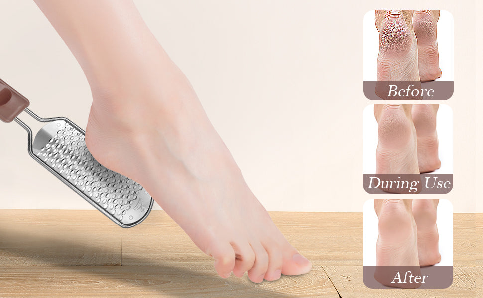 Dũa Chân Silver Star - Lưỡi Lớn Trắng 51115