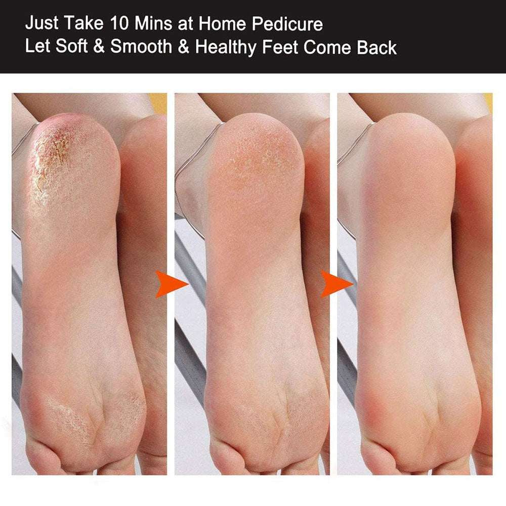 Lưỡi dũa chân Silver Star loại nhỏ - Pedicure File 51117