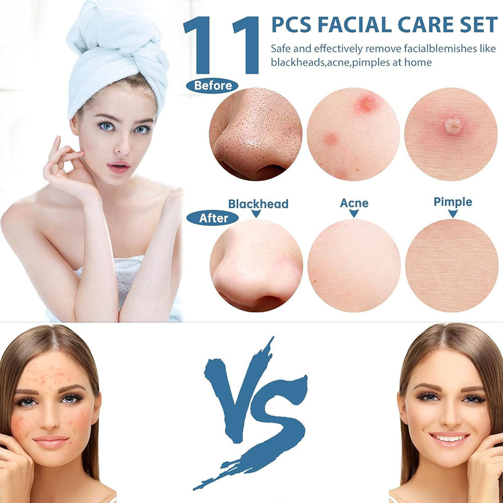 11Pcs Acne Pimples Blackhead Remover Set 45950