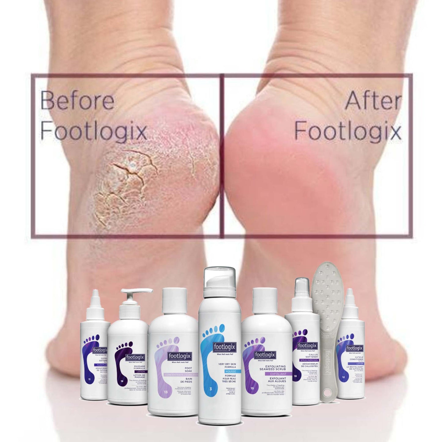 Footlogix The Power 8-Piece Professional Kit 01410