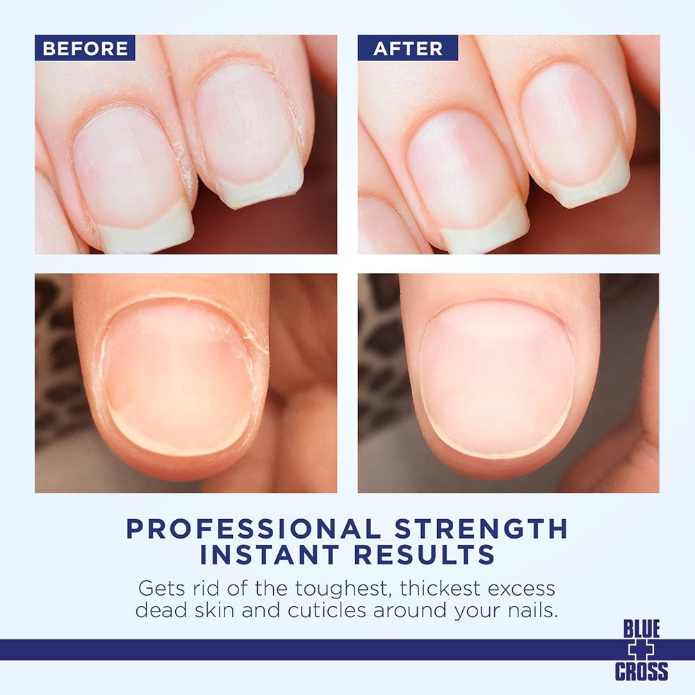 Blue+Cross Cuticle Remover 6 fl oz / 177 ml #106 45914