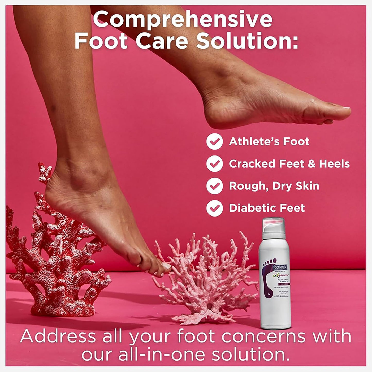 Footlogix Rough Skin Formula (7+) Mousse  4.23 oz.  21131