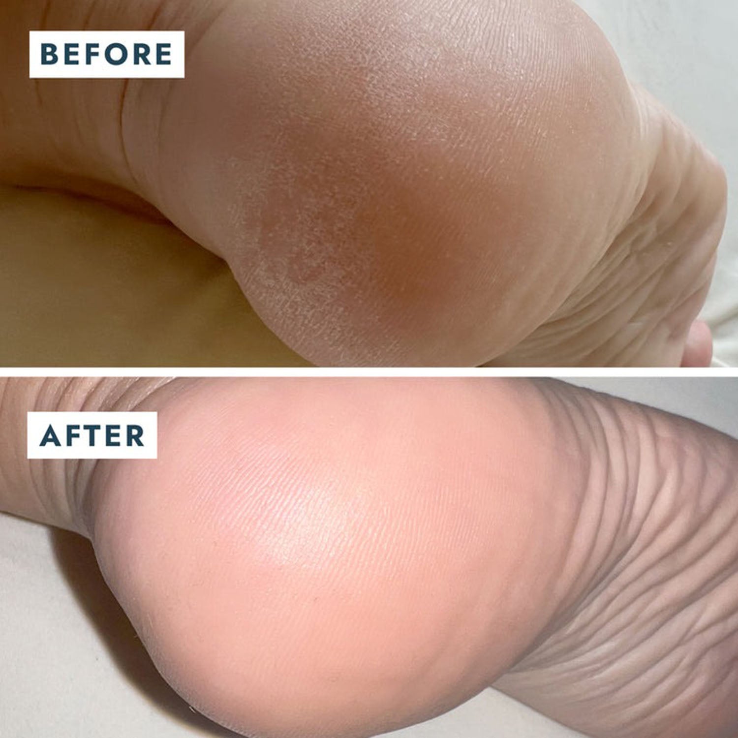 Voesh Solemate Heel Repair Duo VFC001MNT 23210