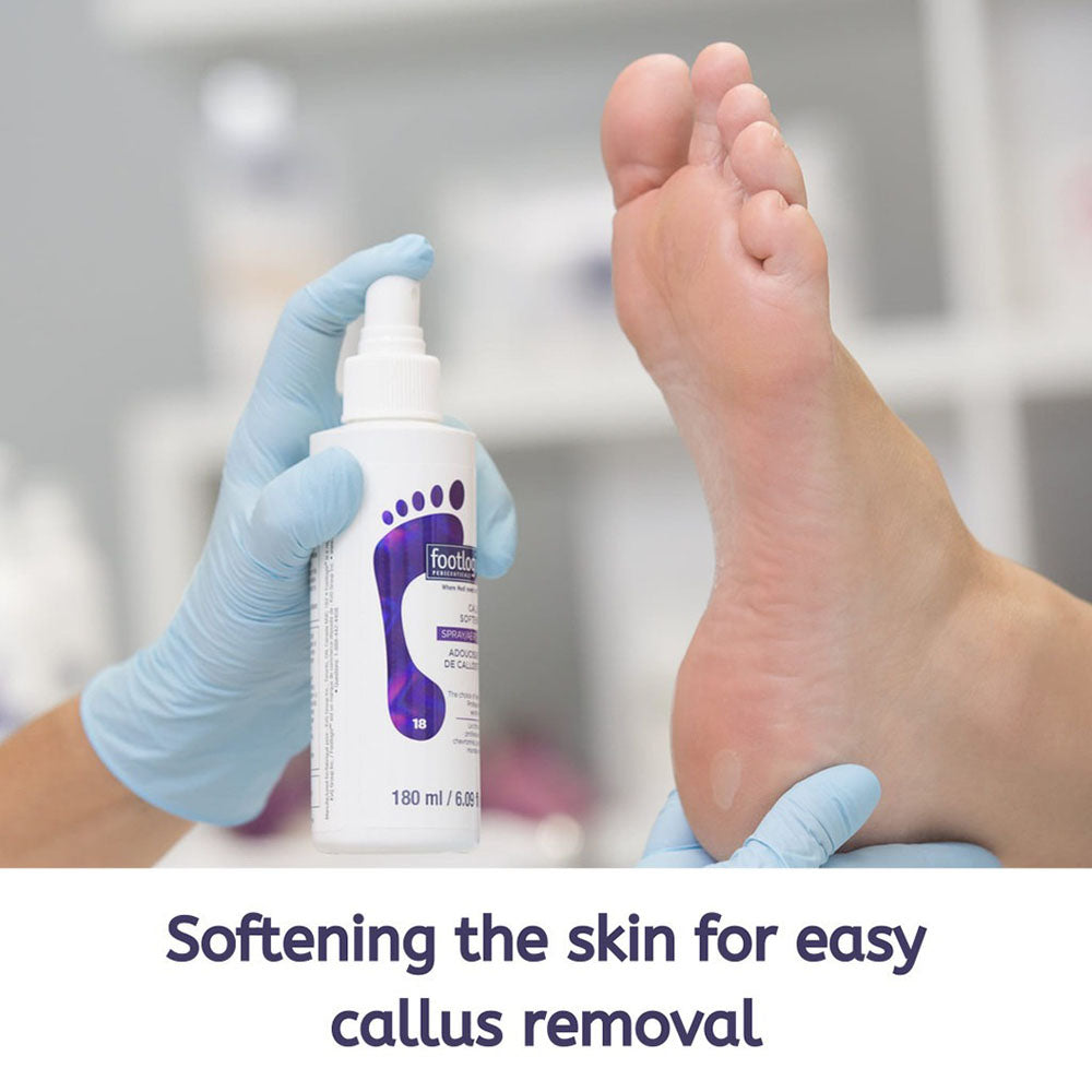 Footlogix Callus Softener (18) Spray 6.09 oz.- 180 ml #41111