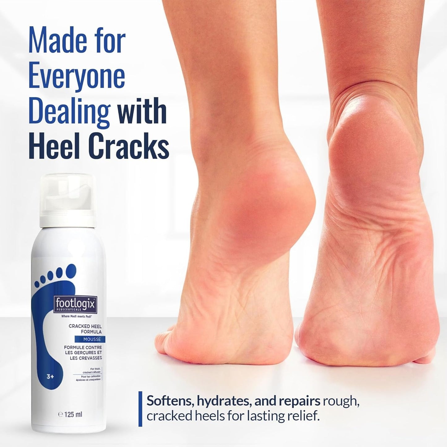 Footlogix #3+ Cracked Heel Formula Mousse 4.23 oz. 04131