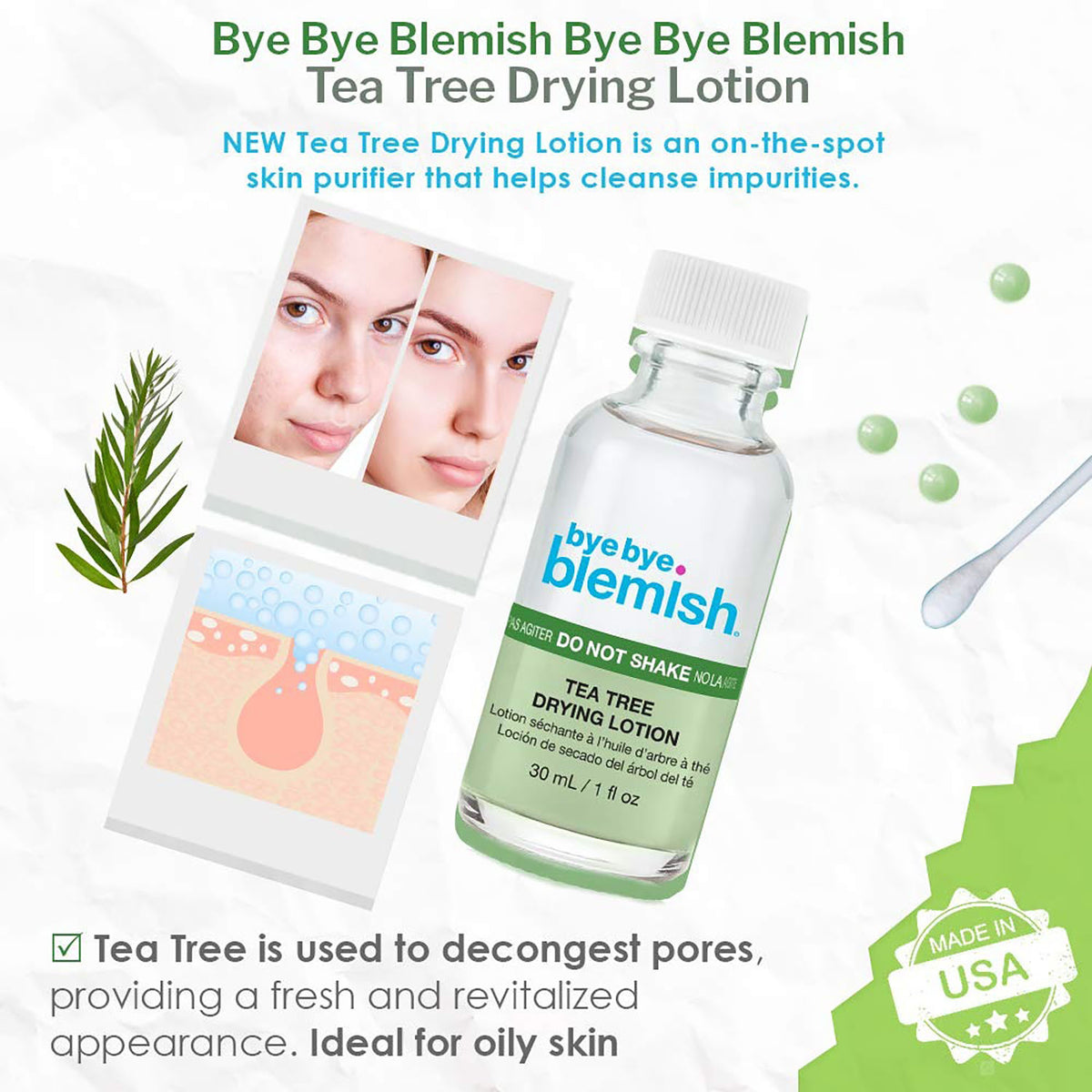 ByeBye Blemish Lotion Asséchante à l'Arbre à Thé 1 fl oz 30 ml 16402