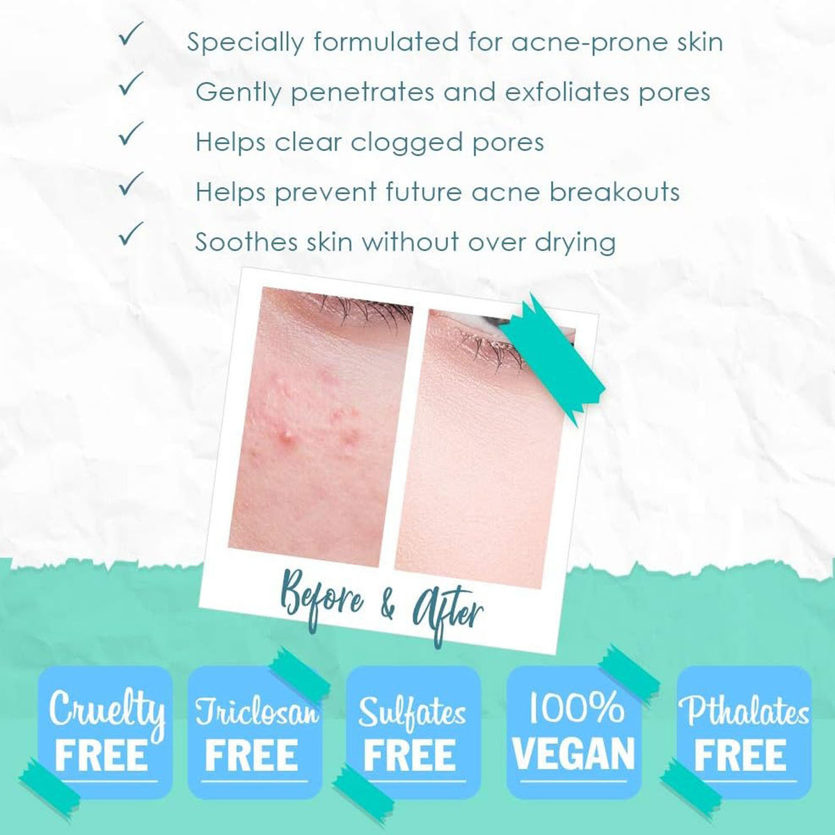Sữa Rửa Mặt Trị Mụn ByeBye Blemish 8 fl oz 236ml 51923