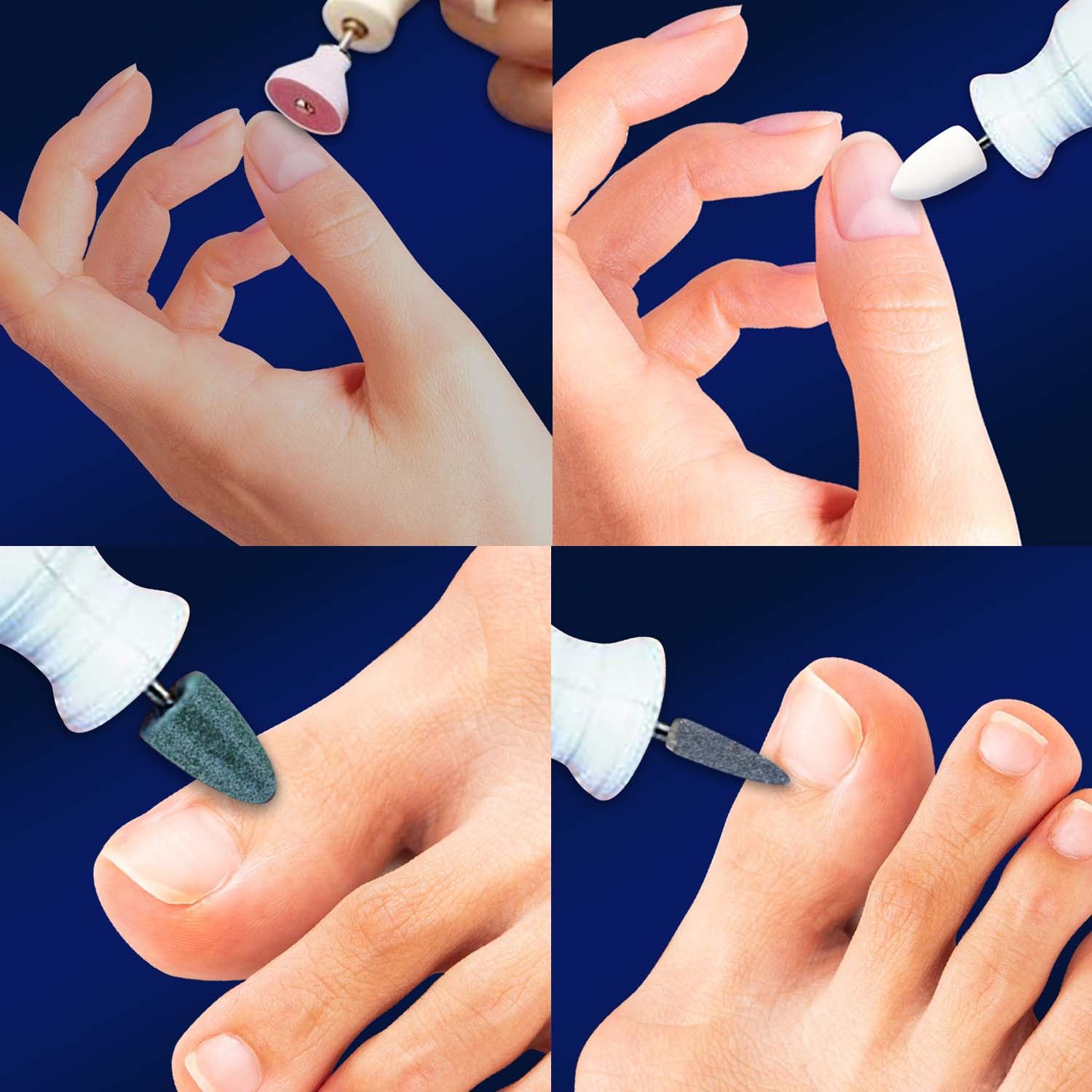 Medicool Manicure- Pedicure Nail & Foot Care MANI-PED STA-1